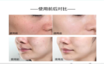RECORE SERUM DDS 蓝胶 48 粒 - 图片 8