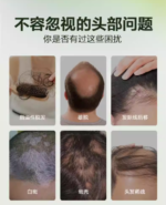 【单独下单】生发水30ml*12支 - 图片 3