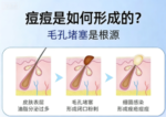 【单独下单】佐藤 祛痘膏10g*10支 - 图片 3